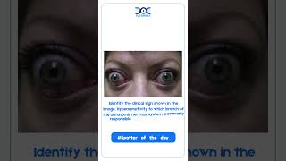 Spotter of the Day | DocTutorials MBBS