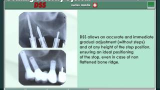 DSS   4  EN   ADVANTAGES