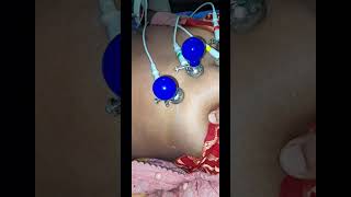 How To Record ECG || ECG Leads Color Coding And Placement Location || ECG kaise kare #viral #video