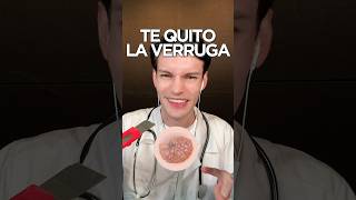 TE QUITO LA VERRUGA #asmr #shorts #asmrsounds #comedia