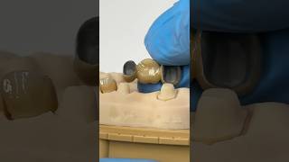 Crown and Bridge @EnvisiontecMain #envisiontec #lsk121shorts #dentistteeth