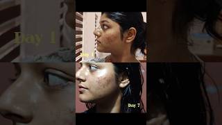 Wishcare vitamin c serum #trending #fyptiktok #exploreshorts #foryoupage #skincareroutine #vitaminc