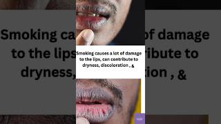 #lips #pigmentation #lipbalm #lipcare #lipprimer #quickresults #darklips #trending #amazonfinds #lip