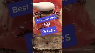 The BEST toothbrush for Braces 🪥 🦷