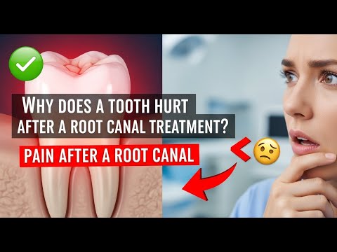 ✅ Why does a tooth hurt after a root canal treatment? / Pain after a root canal 👈😳