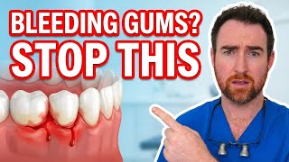 Bleeding Gums? Here's What Your Dentist Wants You to Know