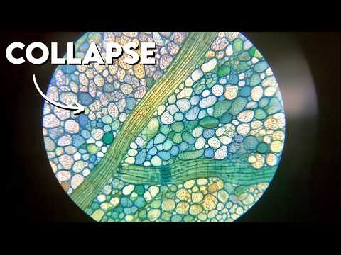 What Would Happen If All Microbes Disappeared Overnight?