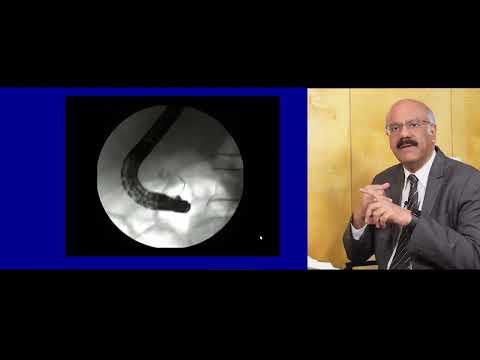 ERCP basics part 2