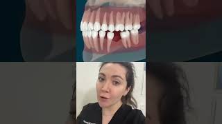 What Happens When A Tooth Is Removed?