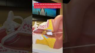 Ear Wax Removal - Stop using Q-Tips in your Ears - Audiology (Doctor of Audiology)