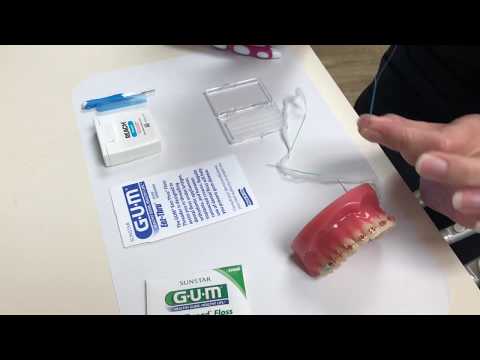 How to Take Care of Your Braces: Nirenblatt Orthodontics