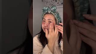 Normalize acne and bad skin days ✨ #skin #skincarejunkie #skincareasmr #skincareproducts