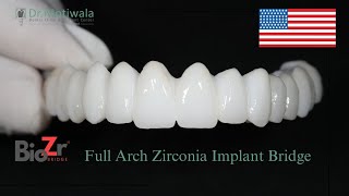 Yelena from the USA gives a 13 year of Full Mouth Dental Implants in India | Success Story