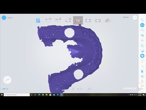 Multiple Implants