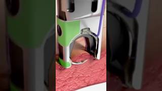 Automatic Surgical Stitch Devices! 😷 #goodtoknow #funfacts #vet #medicine #technology #suturing