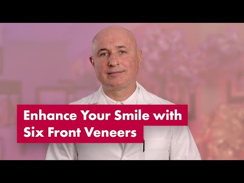 Enhance Your Smile with Six Front Veneers