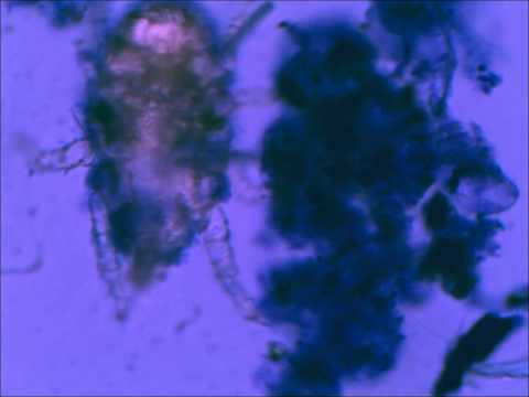 House Mites Nymph under Microscope
