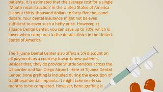 Tijuana Dental Center: Personalized dental services at attractive rates!