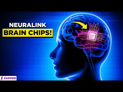 Elon Musk's Brain Chip Revolution: The Rise of Neuralink