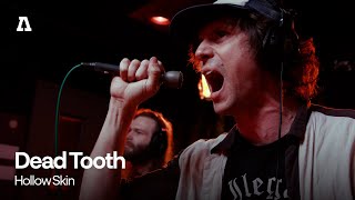 Dead Tooth - Hollow Skin | Audiotree Live