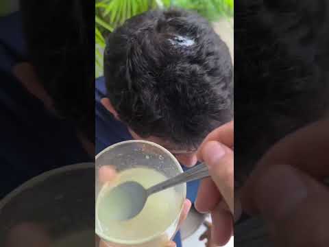 Elimine las canas sin productos químicos con sólo dos ingredientes, ¡un procedimiento natural#viral