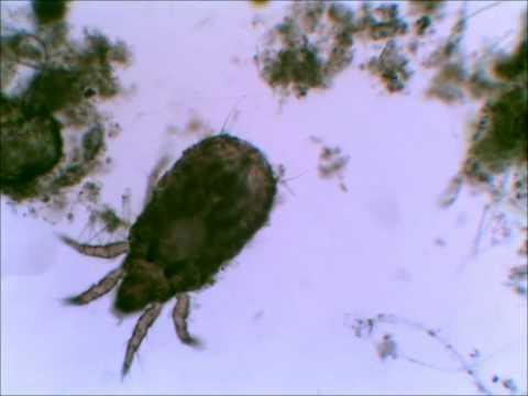 House Mite under Microscope Take 3