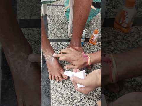 #skine #infection #🤔