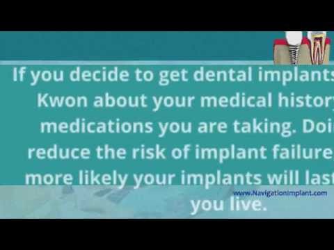 What is the Lifespan of A Dental Implants? (1/20)