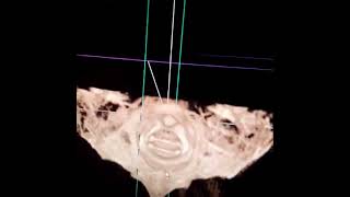 3D Imaging for Precise Results