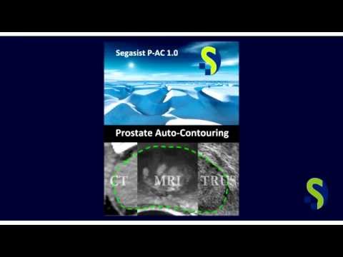 Segasist Technologies (Introduction) - Auto-Contouring Tools for Medical Images