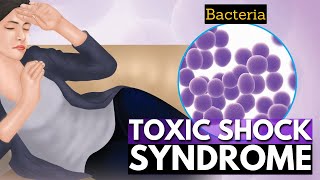 Toxic Shock Syndrome: A Closer Look at the Rare but Serious Condition