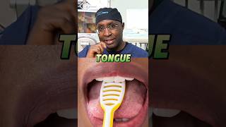 Expert says THIS about cleaning the tongue! | Dentist in Nairobi Kenya