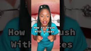 How to brush with braces🪥 #braces #hygienist