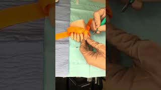 R2 Project - Vandenbos Procedure