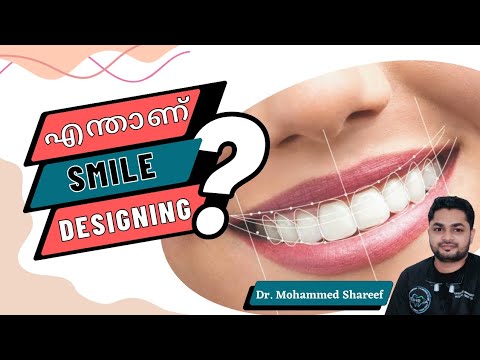 എന്താണ് Smile Designing| Smile Correction Treatment