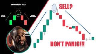 These Candlestick Patterns Scream BUY or SELL—Can You Spot Them?