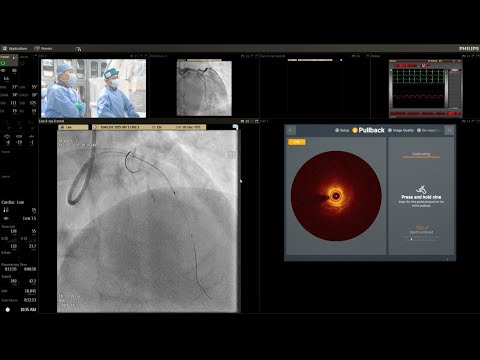 Left Main /Calcification -  Singapore LIVE 2025