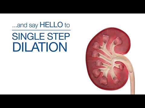 Kidney Stone Removal Animation - Infuse Medical