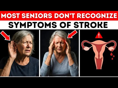 OVER 60? 9 Early Signs of Stroke (It Shows 1 Week Before)