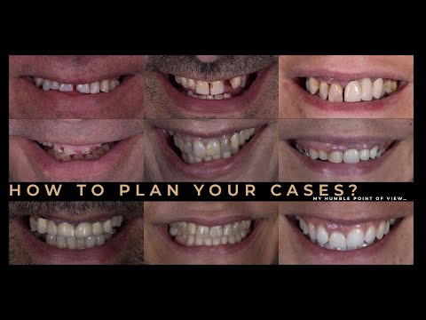 How to Plan your cases? My humble point of view...