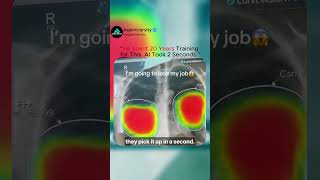 “AI Outsmarts Radiologists? The Truth Behind the X-Ray Revolution!”