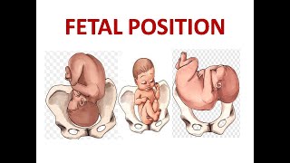 FETAL POSITION