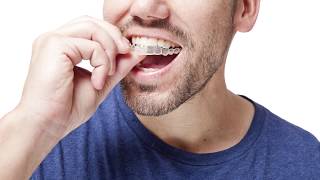 FAQ - What is Invisalign? | Washington Dental Associates
