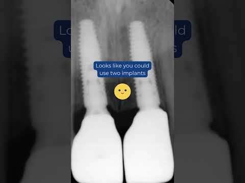 Missing something? (Dr  Juan Fernando Uribe, Dental Tourism Colombia)