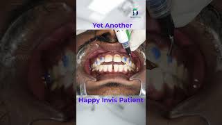 Invis is The New Way of Clip Treatment | Denta Kings