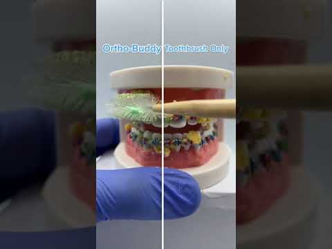 REMOVING FOOD FROM BRACES!!?! best #toothbrush for #braces? #Shorts
