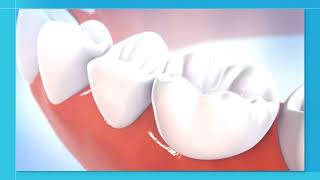 Product Information 3M Single Bond Universal  Dentbear.com