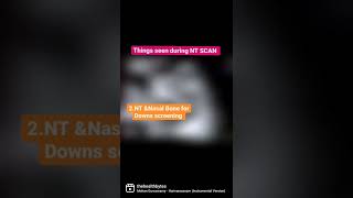 NT scan  in #pregnancy  #pregnancycare #ntscan #downsyndrome #ultrasound #pregancyultrasound