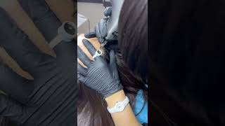 Forehead Hairline Visual Enhancement | Before & After with SCATTER #SCATTER #HairlineEnhancement