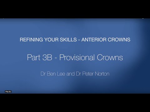 Anterior Crowns - Part 4: Provisional Crowns